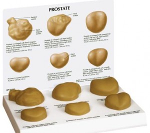 Prostate Cancer