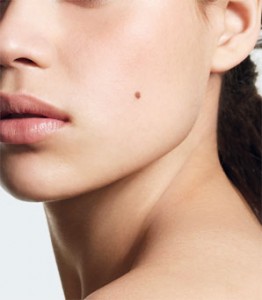 How to get rid of moles